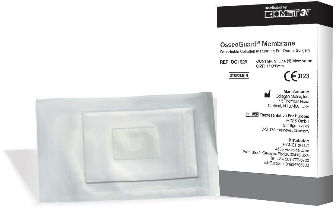OsseoGuard и OsseoGuard Flex